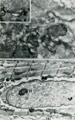 Particolare di una fibra muscolare (fibrocellula o miocita) in cui è ben visibile il nucleo allungato; e forte ingrandimento del miocita