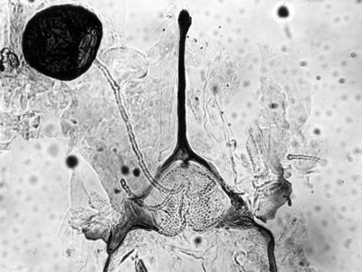 Foto di furca genitale e spermateca di un dittero Simulide femmina