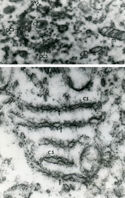 Porzioni di citoplasma contenenti un particolare arrangiamento del reticolo endoplasmatico (lamelle annullate), caratteristico delle cellule germinali e tumorali