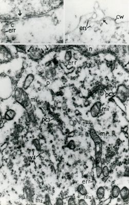 Porzione del citoplasma contenete numerosi mitocondri. La freccia nell'inserto in alto a sinistra indica un poro dell'involucro nucleare