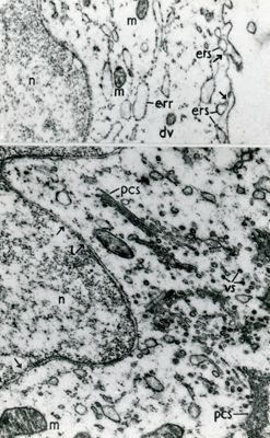 Particolari di due cellule in cui sono visibili il nucleo (n) e porzioni di citoplasma con mitocondri (m), reticolo endoplasmatico (err e ers), vescicole (vs)