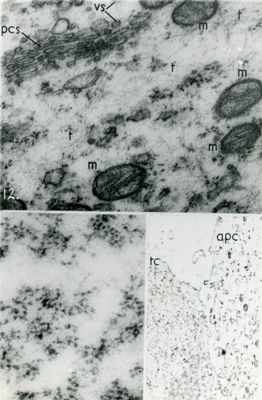 Particolari a forte ingrandimento del citoplasma di una cellula. Nella microfotografia in alto sono visibili l'apparato del Golgi ed alcuni mitocondri