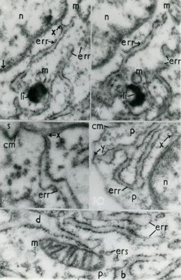 Dettagli del citoplasma cellulare in cui sono evidenziate porzioni del reticolo endoplasmatico rugoso (err)