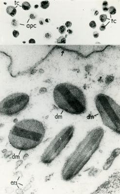 Cellule del sangue. In alto: globuli bianchi (leucociti) osservati a basso ingrandimento. In basso: granuli caratteristici presenti nel citoplasma dei granulociti eosinofili