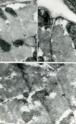 Particolari di sezioni trasversali di fibre di tessuto muscolare