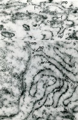 Particolari del reticolo endoplasmatico rugoso