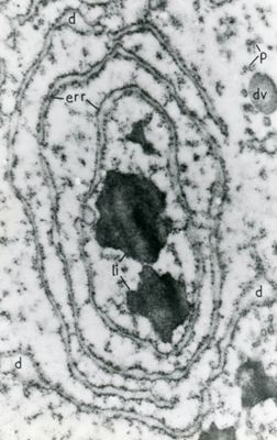 Reticolo endoplasmatico rugoso (err) che circonda due strutture irregolari elettrodense identificate come lisosomi (li)