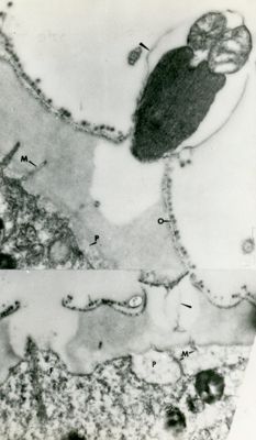 Interazione di uno spermatozoo con la membrana di un ovocita. In alto a destra è visibile la testa dello spermatozoo contenente l'acrosoma ed il nucleo e l'inizio della porzione intermedia contenete due mitocondri