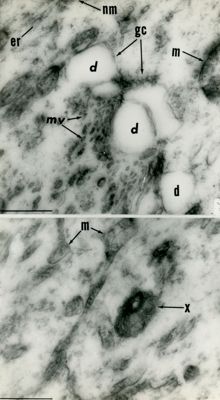 Dettagli ultrastrutturali di porzioni di citoplasma