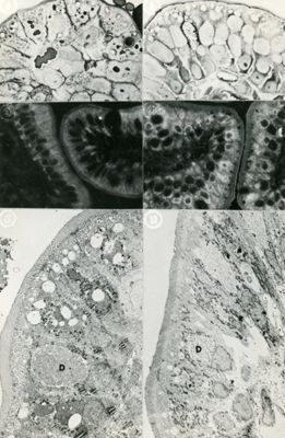 Immagini a basso ingrandimento di epiteli cilindrici semplici