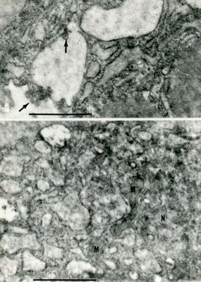 Porzioni di citoplasma fortemente vacuolizzato