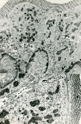 Due diverse sezioni di epitelio cilindrico semplice cigliato. Nella micrografia superiore sono visibili tre cellule epiteliali adiacenti