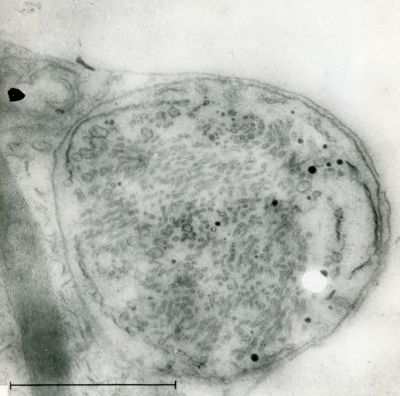 Particolare della sezione di un campione biologico che mostra una struttura, delimitata da una doppia membrana, rilasciata da una cellula microbica o vegetale (possibile spora)