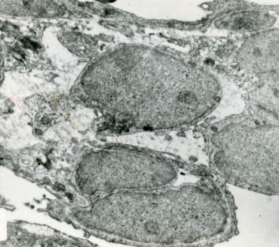 Sezione di tessuto che mostra cellule con nuclei ben conservati e citoplasma alterato