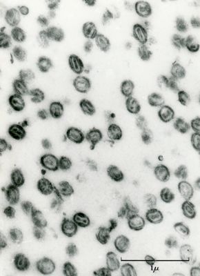 Sezione ultrasottile di una sospensione di poxvirus (virus vaccinico)