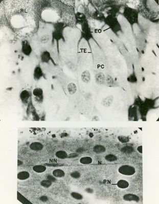 Sezioni semifine osservate al microscopio elettronico a basso ingrandimento