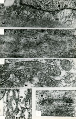 Composizione di micrografie elettroniche che mostra diverse strutture subcellulari, quali nucleo (N), fasci di microfilamenti (M), mitocondri (Mi), vacuoli (V)