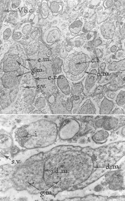 Particolari a forte ingrandimento di un campione biologico costituito da numerose e complesse strutture vescicolari delimitate da membrane