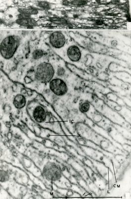 Particolare del citoplasma contenente numerosi mitocondri tondeggianti all'interno di un convoluto reticolo endoplasmatico