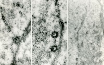 Forme intracellulari di virus erpetico. Le due particelle in alto a sinistra sono forme immature prive di "envelope". La particella sottostante sta acquisendo l'envelope usando le membrane citoplasmatiche mentre le due particelle dell'immagine centrale sono forme complete