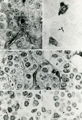 Composizione di diverse micrografie elettroniche effettuate a basso ingrandimento su un campione biologico. Sono ben visibili i nuclei delle cellule