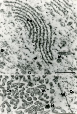 Particolari del citoplasma di una cellula. Sono visibili il reticolo endoplasmatico (in alto) e numerosi mitocondri e vescicole (in basso)