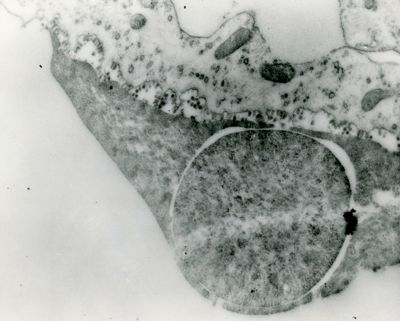 Particolare di una sezione di membrana corio-allantoidea di embrione di pollo. Numerose particelle di virus dell'influenza sono presenti nello spazio tra la membrana e l'adiacente emazia