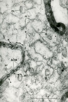 Porzione di citoplasma cellulare in cui sono visibili mitocondri (mi), vacuoli (v), membrane del reticolo (m) ed una figura mielinica (My)