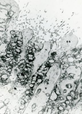 Immagine suggestiva di un epitelio ghiandolare. Il basso ingrandimento non permette di chiarire la natura delle piccole strutture che fuoriescono dalle cellule (particelle similvirali o microvirali)