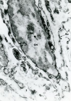 Particolare di un tessuto in cui sono evidenziate le giunzioni (BM) tra cellule adiacenti