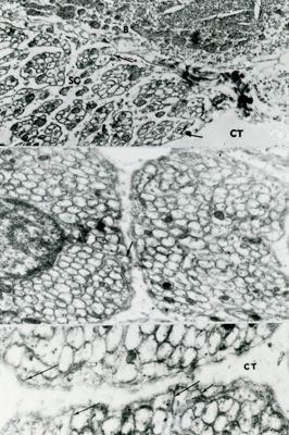 Particolare ad ingrandimento crescente di una ghiandola sebacea. Le cellule mostrano il citoplasma pieno di vacuoli contenenti il materiale di secrezione