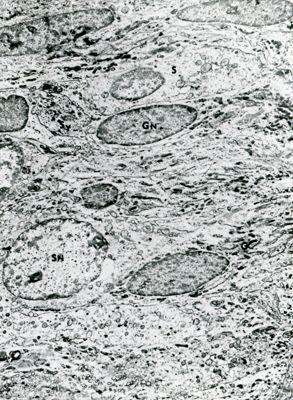 Sezione ultrasottile di un tessuto osservato a basso ingrandimento. Le cellule mostrano nuclei eterogenei