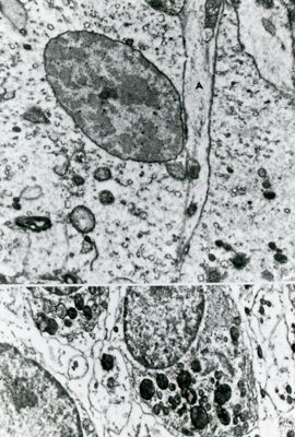 Sezioni ultrasottili di cellule con nucleo ben preservato e citoplasma molto estratto