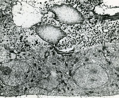 Particolare della sezione di un epitelio cubico semplice. In basso: cellule epiteliali; in alto: cellule del connettivo