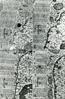 Quattro particolari diversi di fibrocellule. A destra sono visibili porzioni dei nuclei mentre a sinistra sono visibili le miofibrille con la caratteristica struttura a bande