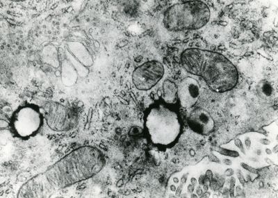 Porzione di un citoplasma di una cellula in cui sono visibili diversi organuli quali mitocondri e vescicole