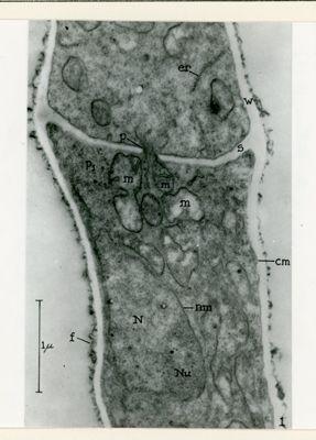 Fotografia elettronica di Neurospora