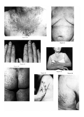 Fotografie di varie parti del corpo umano
Fotografie di varie parti del corpo umano