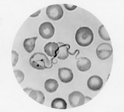 Spirochete della febbre ricorrente (particolare tipo di batteri a forma di spirale)