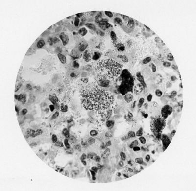 Cellule del polmone di topolino o coniglio contenenti Rickettsia