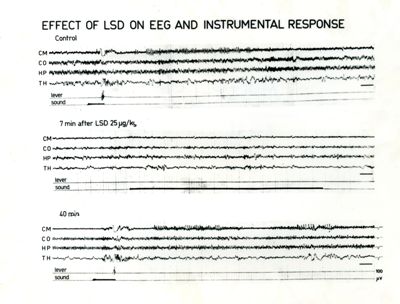 Tracciati EEG sulla risposta al trattamento con LSD