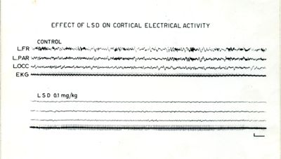 Tracciati EEG: effetti dell'LSD sull'attività elettrica corticale e sull'attivazione corticale ed ippocampale