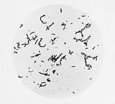 Mycobacterium sp. ceppo Chauviré