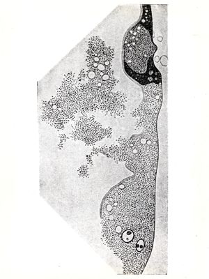 Cellule epiteliali dello stomaco del pidocchio piene di Rickettsia che fuoriescono in parte nel lume dell'organo