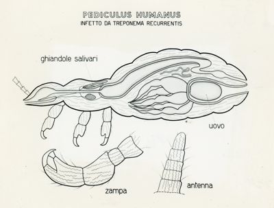 Tav. 135 - Pediculus Humanus infetto da Treponema Recurrentis