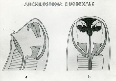 Tav. 168 - Anchilostoma duodenale
