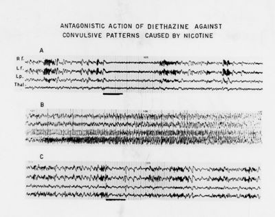 Azione della diotazina sull'elettroencefalogramma