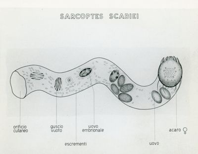 Tav. 192 - Sarcoptes Scabiei