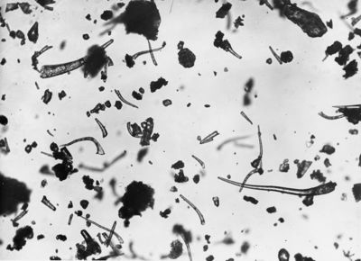 Materiale biologico ingrandito al microscopio