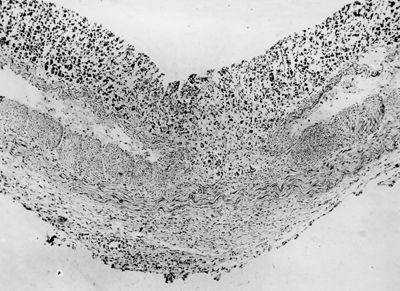 Ulcera sperimentale da istamina nella cavia (fotografie in serie)